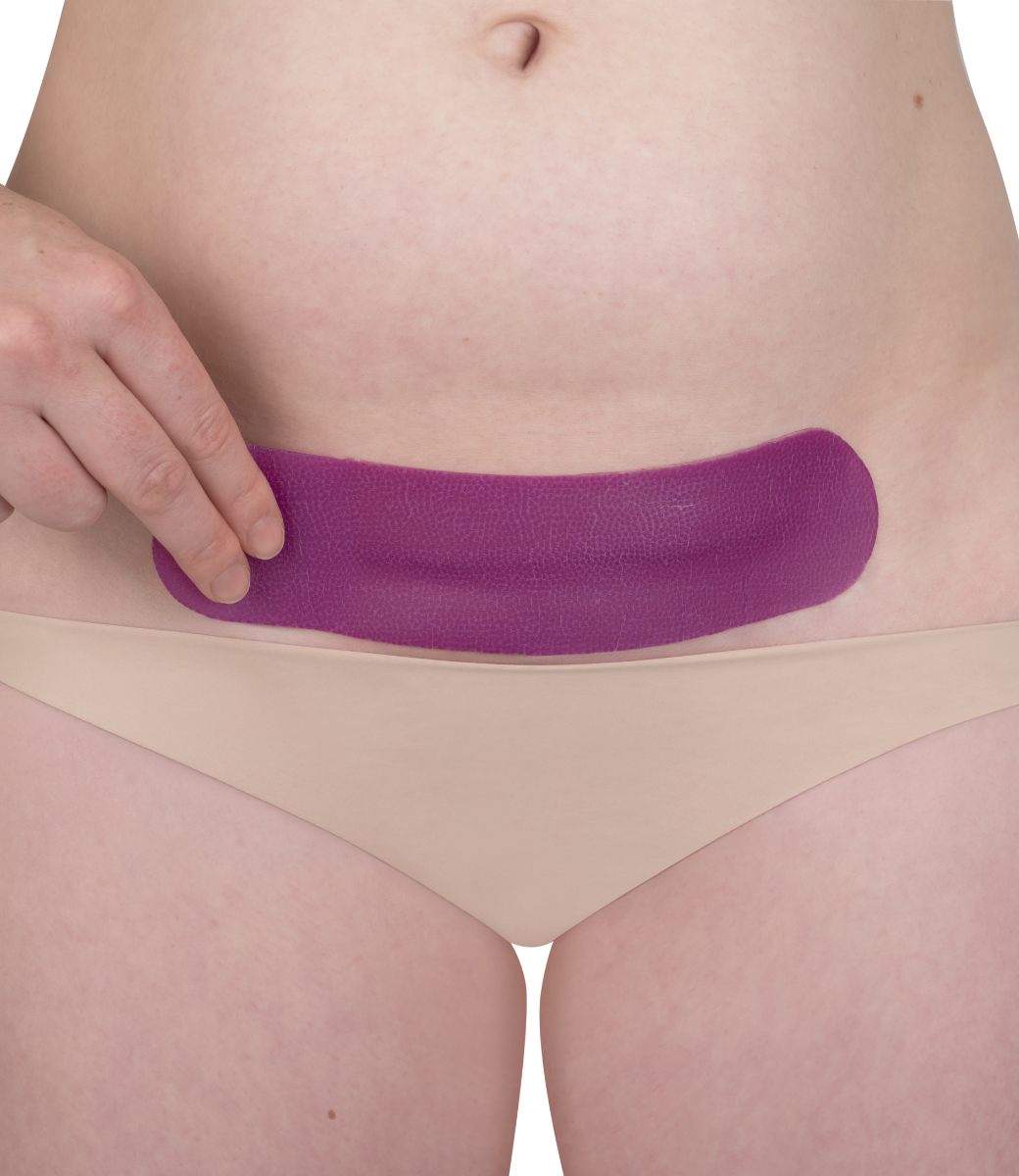 Scarban C-Section litteken siliconenpleister