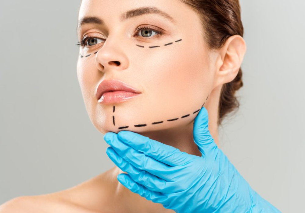 Facelift littekens blog banner